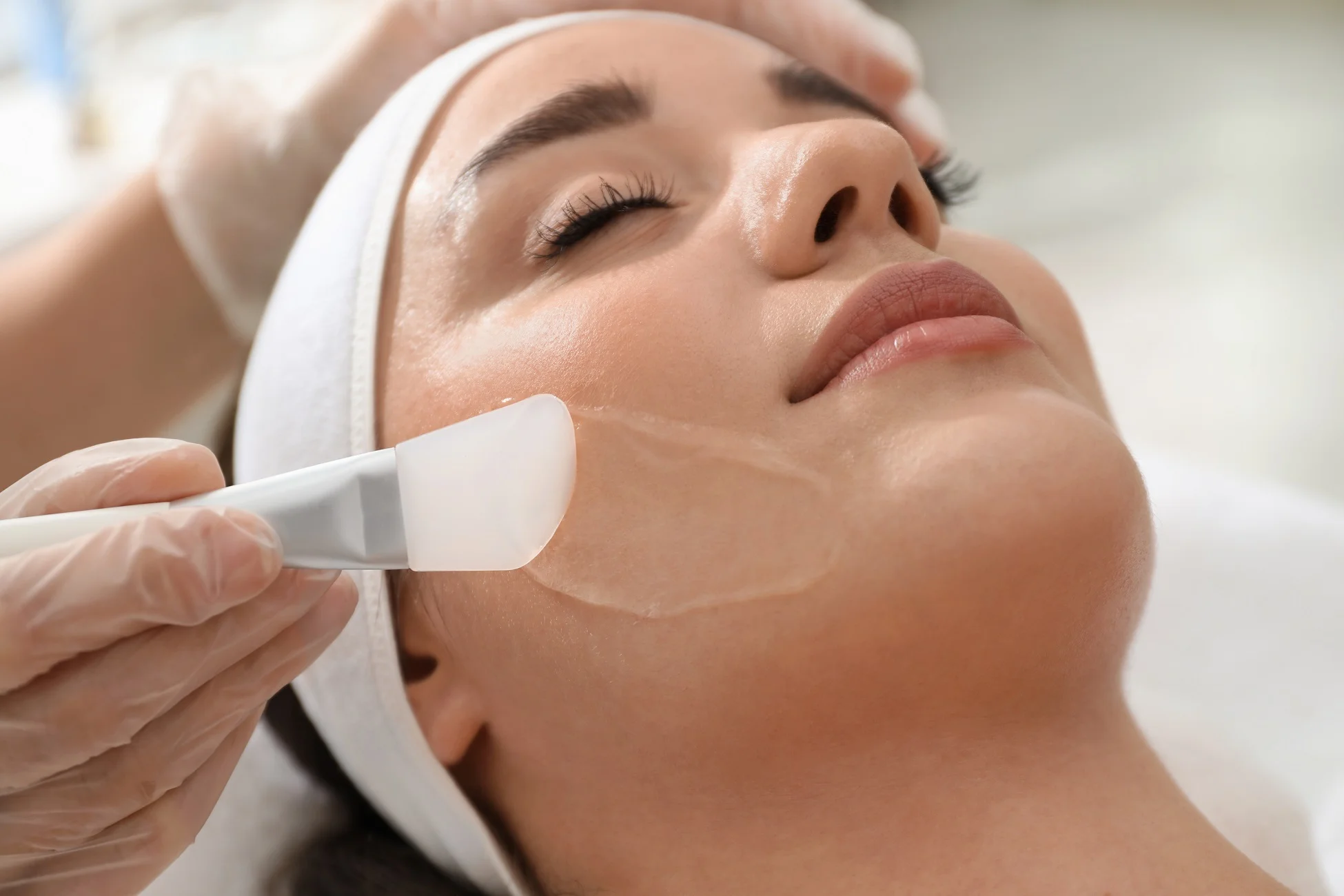Chemical Peels in Milton, MA at Infinite Beauty Lounge