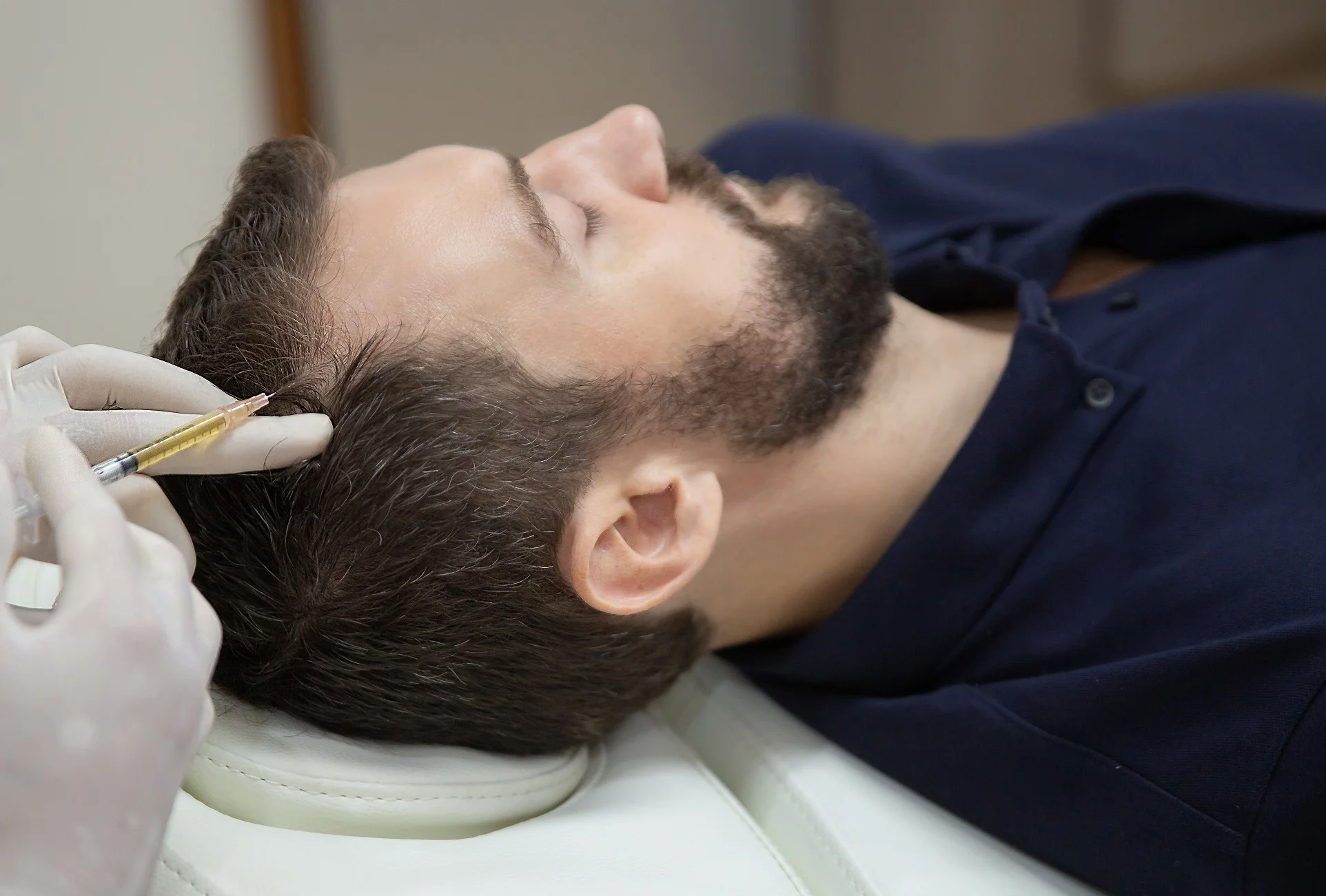 Best Hair Restoration in Milton, MA